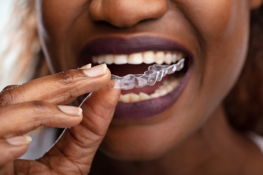 Clear Aligners in Ardmore, Pennsylvania